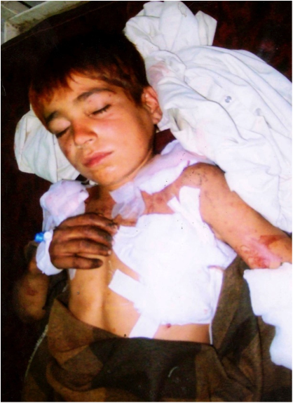 Naeem Ullah was just 10 years old when he died of shrapnel wounds from a drone strike on October 18th 2010 in Datta Khel, North Waziristan.